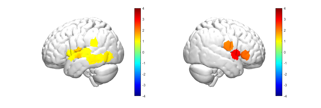 fNIRS Data Processing